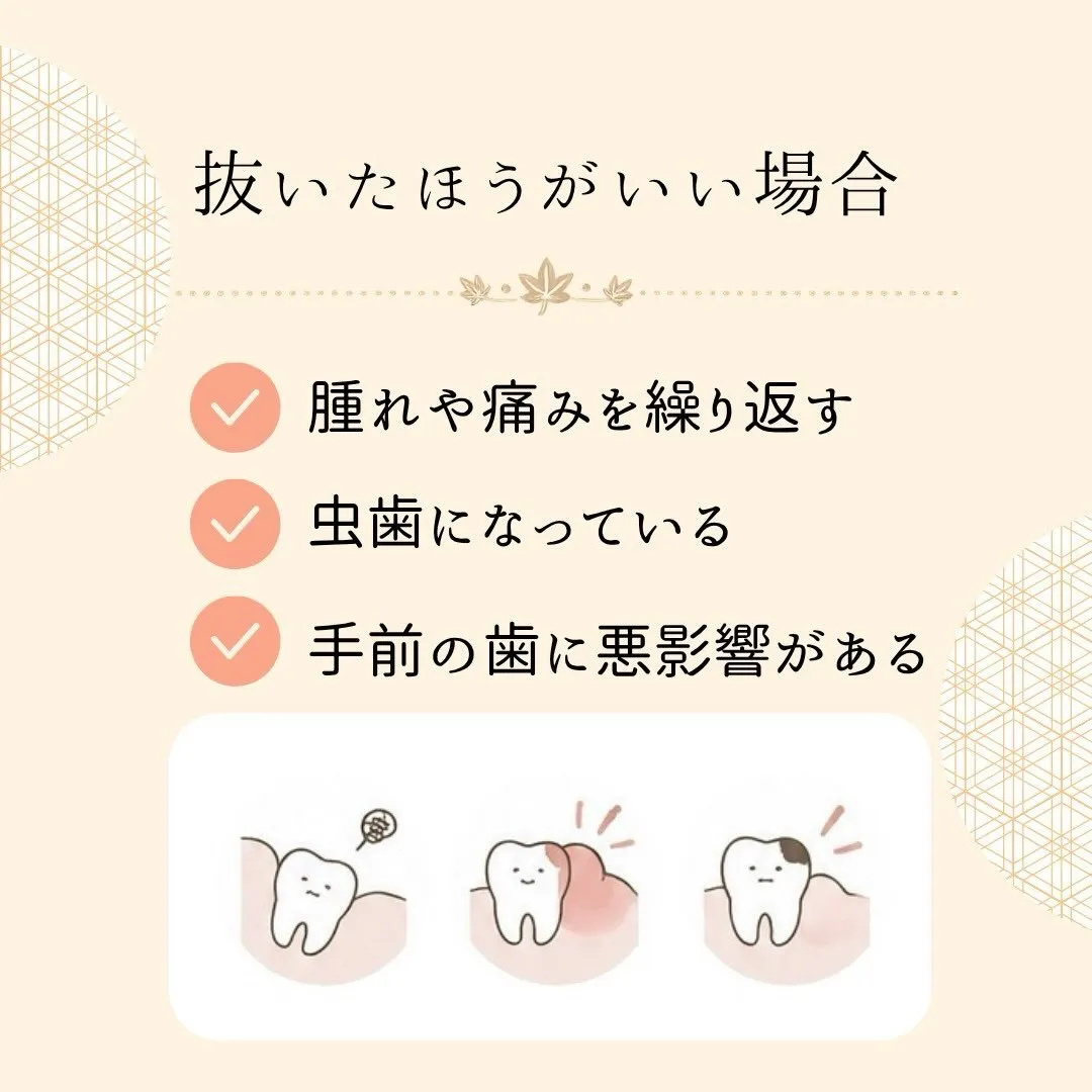 🦷 親知らず、抜いた方がいいの？🤔