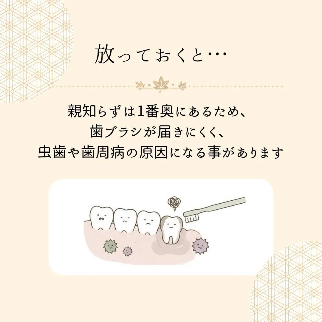🦷 親知らず、抜いた方がいいの？🤔
